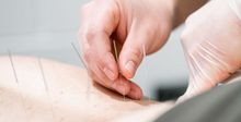 Un plan rapproché de mains qui insèrent des aiguilles lors d'un traitement d'acupuncture